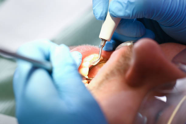 Best Emergency Dental Care for Broken or Chipped Teeth in Armada, MI